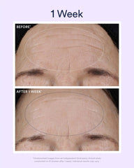Dream Night Serum with Bio-Retinol